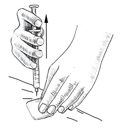 Figure K (Figurek)