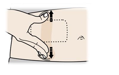 repatha_amgenusa-19.jpg When the blue light flashes, the on body infusor is ready. Keep the stretch (stomach area method only). Hold the loaded on body infusor with the blue light visible, and place it on your skin. You may hear beeps. - repatha amgenusa 19