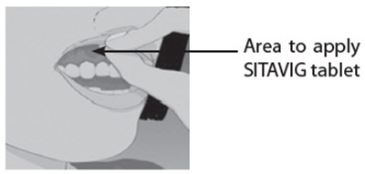 Figure A (Sitavig 02)