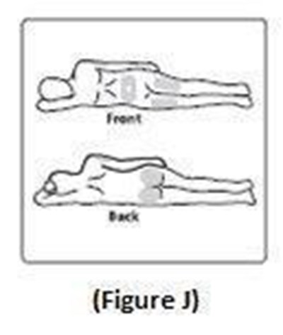 Figure J (70e689b2 1ad1 4632 B851 B38b7ee6e14f 15)