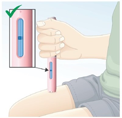 1 (Brekiya   Dihydroergotamine Mesylate Injection 17)