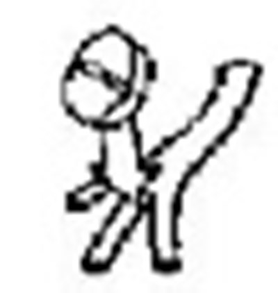 this is an artery - minoxidil 2