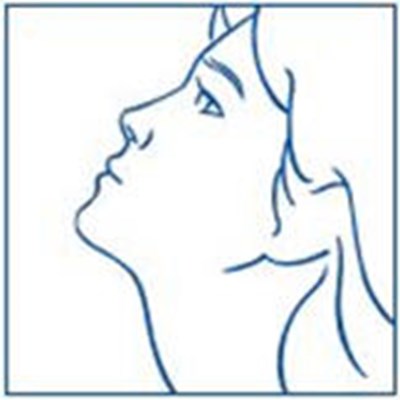 Figure I - synarel 14