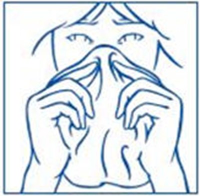 Figure F - synarel 22