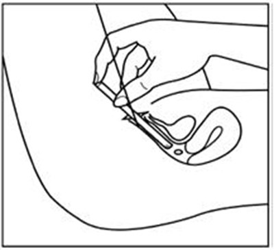 9ec90e26-figure-04 (Estradiol Vaginal Inserts Usp 4)