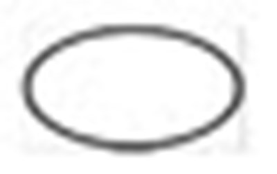 Image (Acuvue 11)