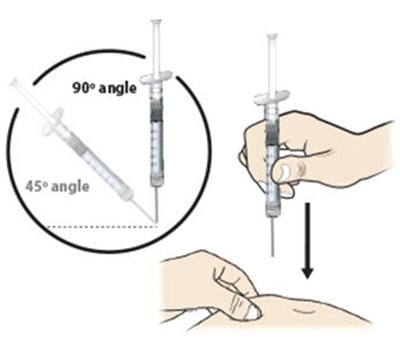 Figure - nivestym 28