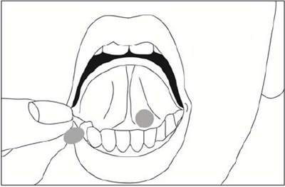 buprenorphine-naloxone-03.jpg Figure 3 - buprenorphine naloxone 03