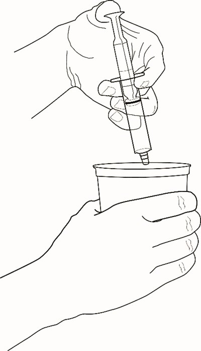 Patient-gal-figure5a-2.jpg (Patient Gal Figure5a 2)