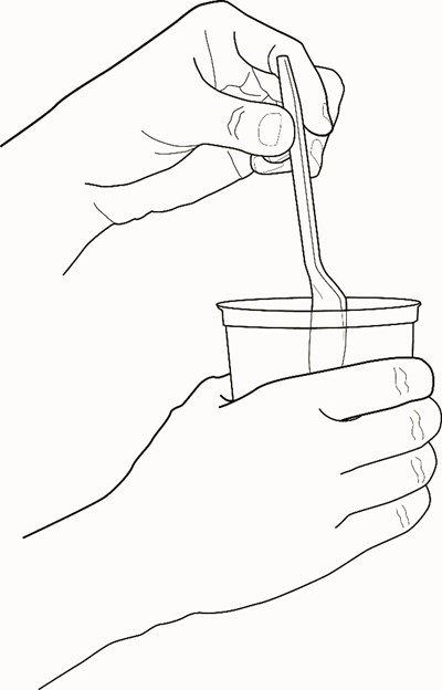 Patient-gal-figure6-2.jpg (Patient Gal Figure6 2)