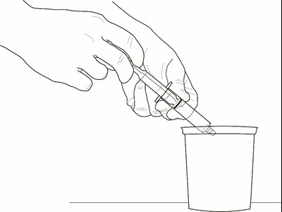 Patient-gal-figure8a-2.jpg (Patient Gal Figure8a 2)