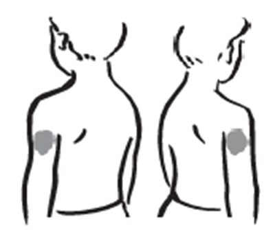 Image (Increlex 10)