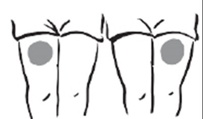 Image (Increlex 11)