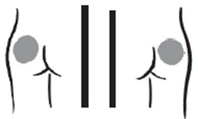 Image (Increlex 12)