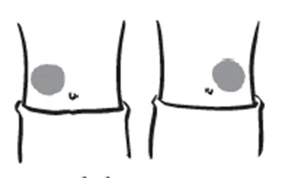 Image (Increlex 13)