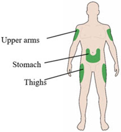 Figure (Lantus 11)