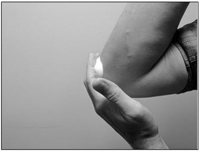 Figure - halobestasol 07