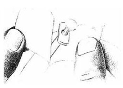 Figure D (Fig D)