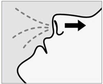 Figure (Spravato 29)