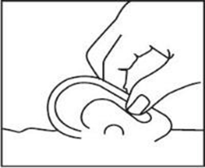 10 (Ofloxacin Otic Solution 6)