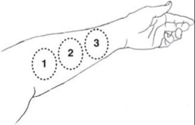 Illustration 4 (Evamist 06)