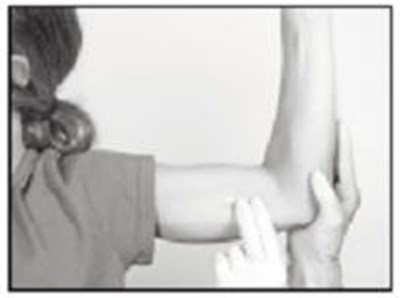 supprelin-la-10.jpg The implant to be removed should first be located by palpating the inner aspect of the upper arm - supprelin la 10