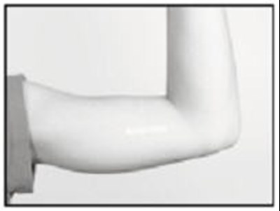 Removal: Closing The Incision (Supprelin La 15)