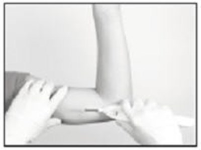 Inserting The Implant (Supprelin La 7)