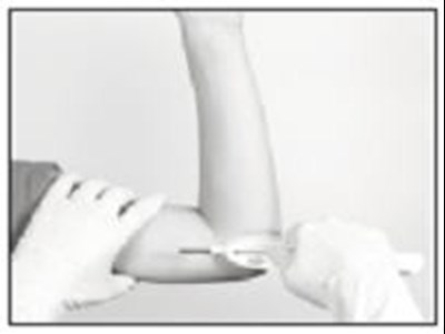 Insertion: Closing The Incision (Supprelin La 8)