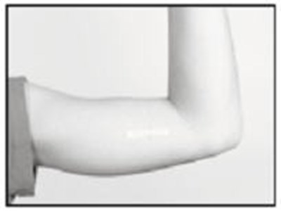 Retracting The Button Causes The Cannula To Withdraw From The Incision (Supprelin La 9)