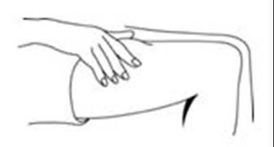 Figure P (Pegasys 16)