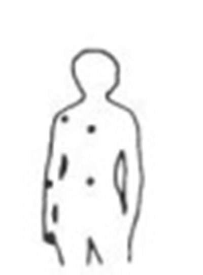 Figure 14 - minoxidil 14