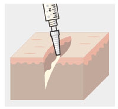 Figure - zynrelef 22