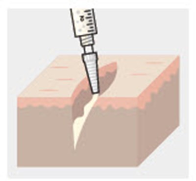 Figure - zynrelef 41