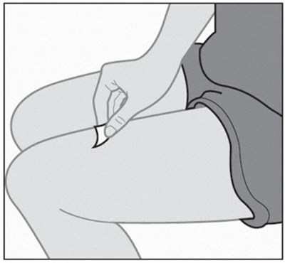 Figure L (Omlyclo 18)
