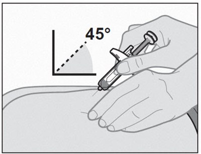 Figure N (Omlyclo 20)