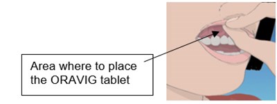 Oravig 02 (Oravig 02)