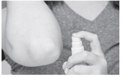 Figure C - betamethasone 04