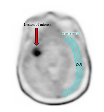 Figure 1 (Pixclara 01)