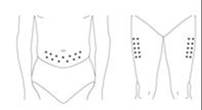 Figure I - pegasys 09