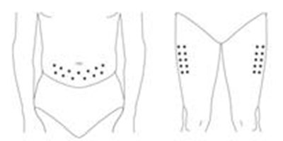 Figure I - pegasys 28