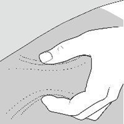 figure f - glatiramer acetate 40 mg per ml 9