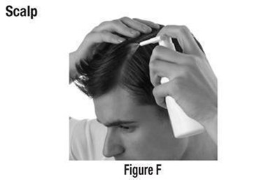Figuref