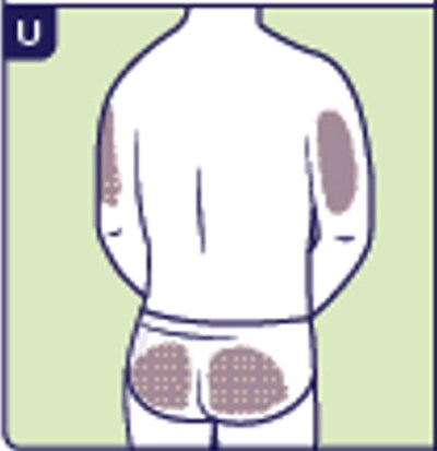 Figure U (Yuviwel 25)