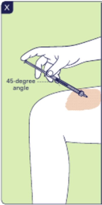 Figure X (Yuviwel 28)