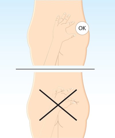 1 (Lanreotide Injection Matoda 18)