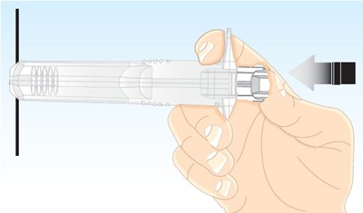 1 (Lanreotide Injection Matoda 21)