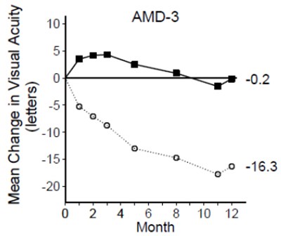 Figure 2 (Sb11 11)