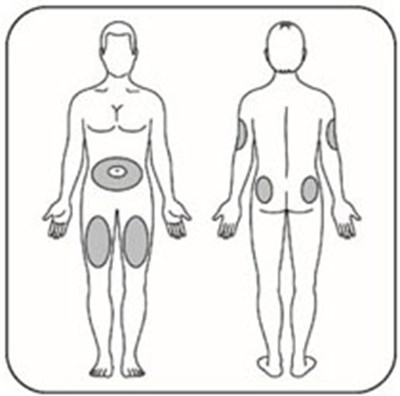Figure (Il Mix75 Inj Site V1)