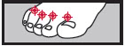 butenafine-01.jpg Figure - butenafine 01